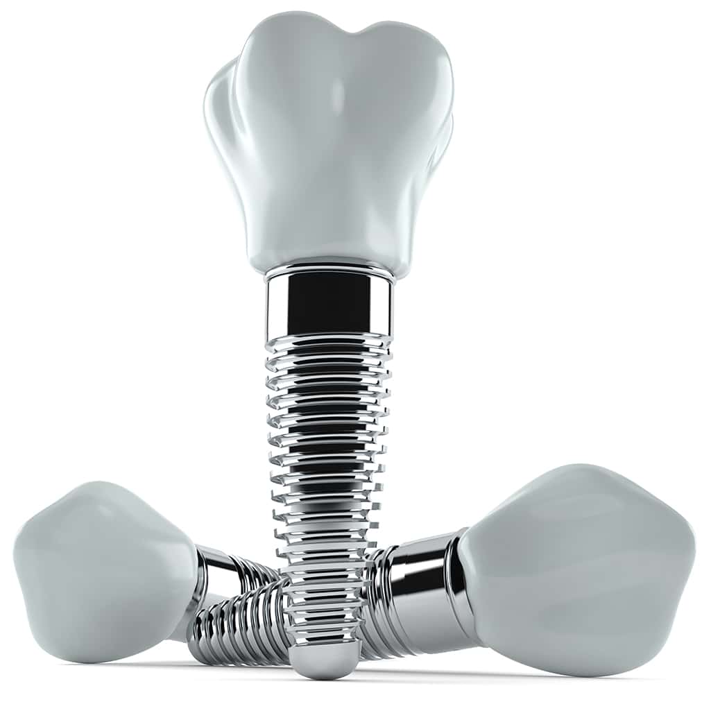 Dental implants are surgically placed into the jawbone to support crowns or dentures, restoring function and aesthetics.